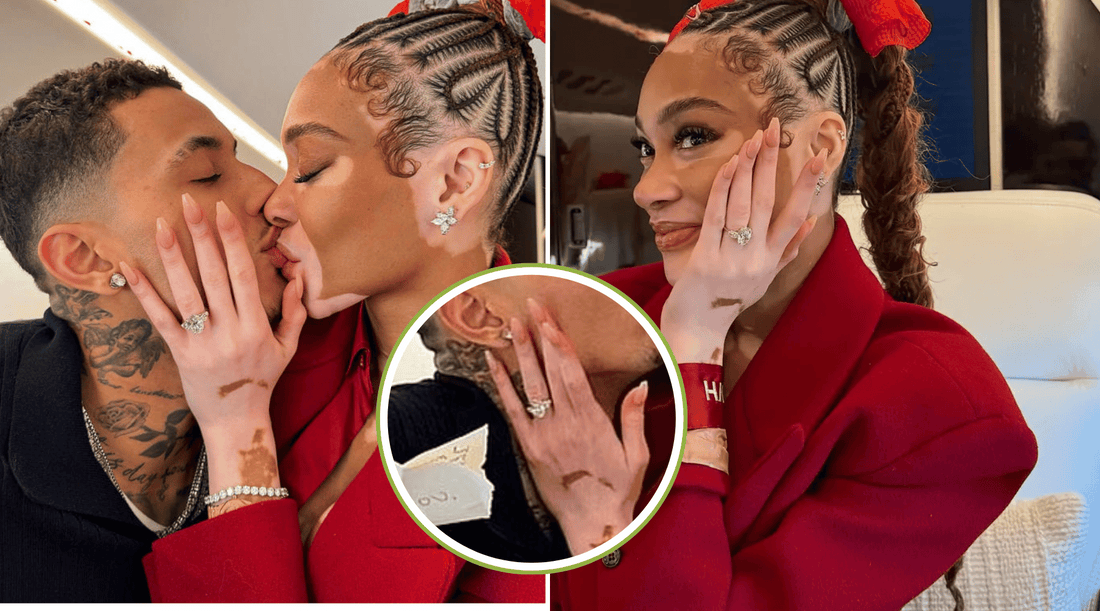 Winnie Harlow’s Engagement Ring: A 41.91-Carat Masterpiece Worth $300K