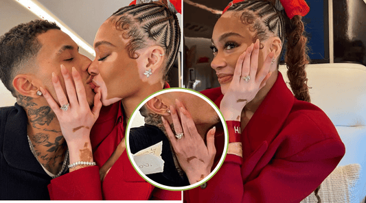 Winnie Harlow’s Engagement Ring: A 41.91-Carat Masterpiece Worth $300K